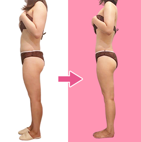 痩身ダイエットba02