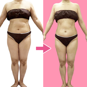 痩身ダイエットba01