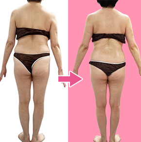 痩身ダイエットba03